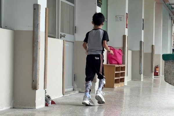 光復8歲童穿上矯具