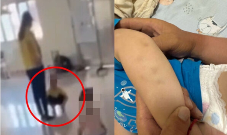 高雄林園幼兒園師對4歲童「胸口碎大石」，屁股瘀青，家長心碎！注意3點常見兒虐痕跡