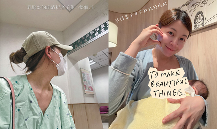 謝京穎乳腺炎化膿抽吸「像萬針在扎」！醫提醒：塞奶別死命揉，出現「這幾種症狀」快就醫