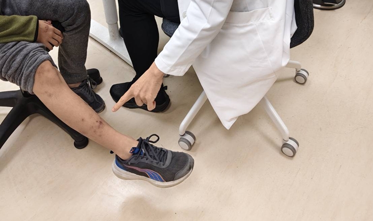 12歲男童苗栗露營，高燒5天紅疹竟是恙蟲病！醫：症狀像感冒，關鍵線索為「黑色焦痂」